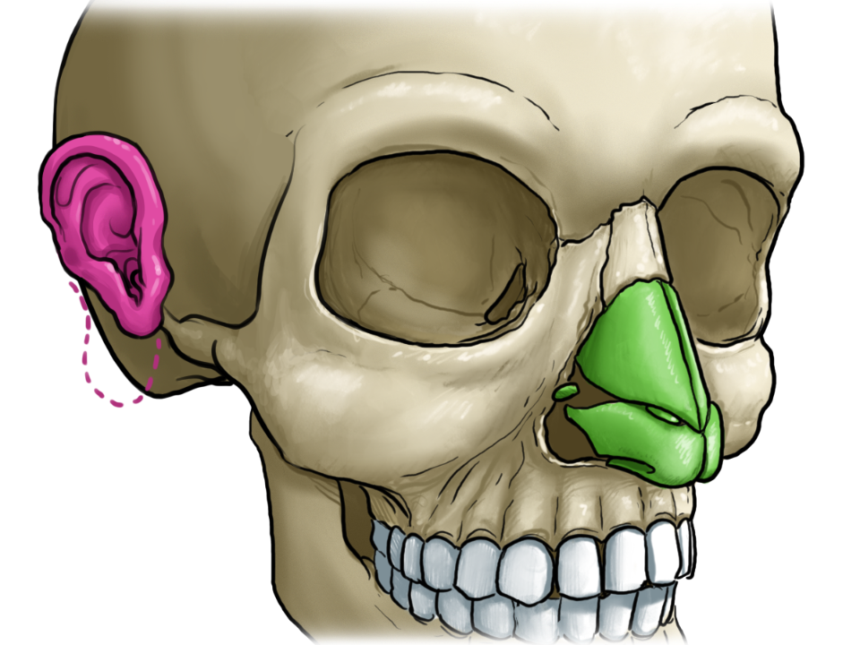 Grafisch dargestellter Skelettkopf mit farbiger Nasenspitze und farbiger Ohrmuschel.