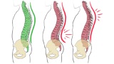 Gesunderhaltung des Skeletts