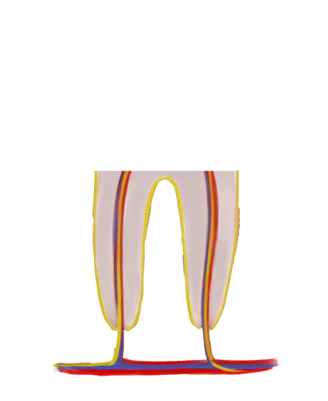 Zahnwurzel