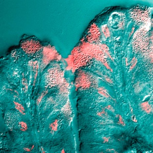 Darmschleimhautzellen mit rosa angefärbtem Sekret (Schleim)