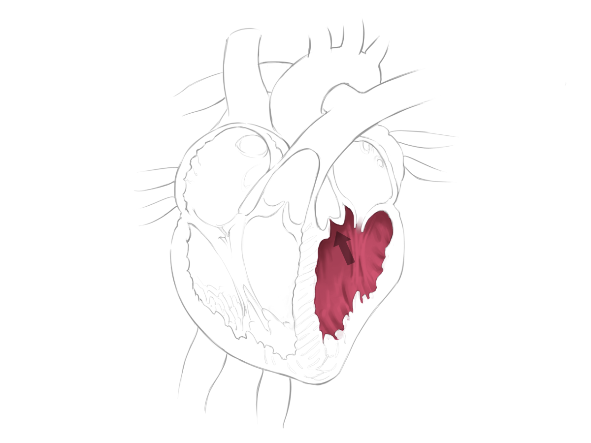 Linke Herzkammer