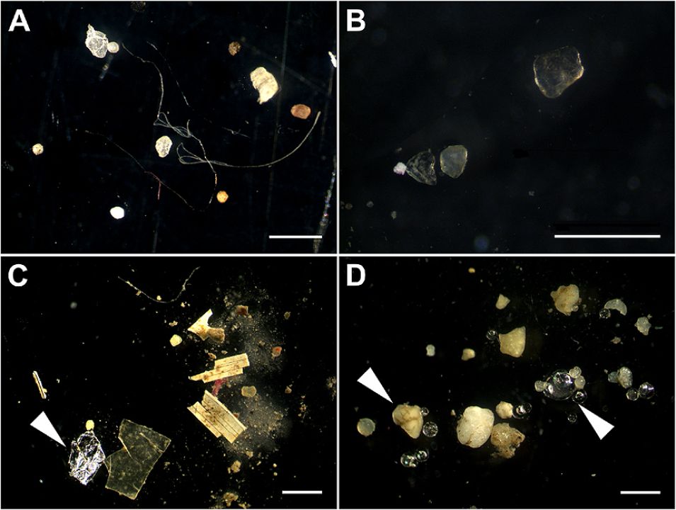 Mikroplastik und weitere Müllpartikel aus Flüssen. 